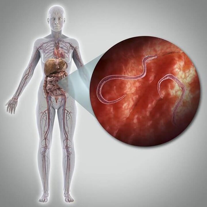 Parásitos no corpo dunha persoa