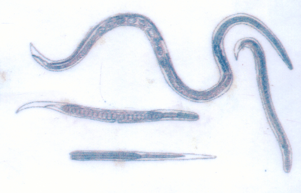 O verme de Guinea, que parasita baixo a pel, é fácil de infectar